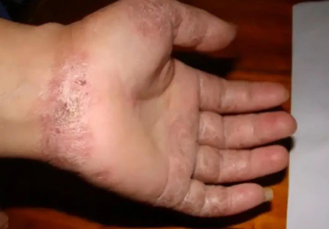 三亿体育要小心了！“温泉鱼”竟是迷你食人鱼？揭露鱼疗背后的恐怖！(图3)